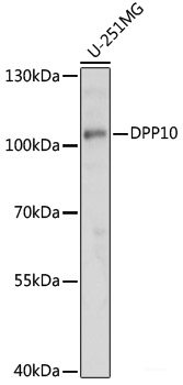 Immunohistochemistry of paraffin-embedded Human liver cancer using COL1A1 Polyclonal Antibody at dilution of  1:200 (40x lens).