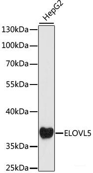 Immunohistochemistry of paraffin-embedded Human colon carcinoma using TOM20 Polyclonal Antibody at dilution of  1:100 (40x lens).