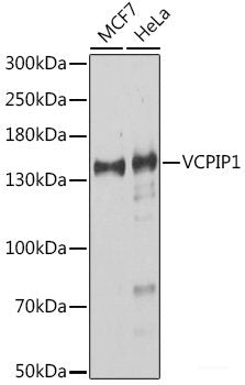 Immunofluorescence analysis of Mouse brain using KCNA1 Polyclonal Antibody at dilution of  1:100. Blue: DAPI for nuclear staining.