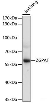Immunohistochemistry of paraffin-embedded Rat brain using MAG Polyclonal Antibody at dilution of  1:200 (40x lens).