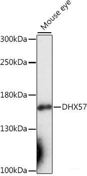 Immunohistochemistry of paraffin-embedded Mouse brain using NEUROD1 Polyclonal Antibody at dilution of  1:200 (40x lens).