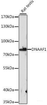 Immunofluorescence analysis of HeLa cells using UGT2B7 Polyclonal Antibody at dilution of  1:100 (40x lens). Blue: DAPI for nuclear staining.