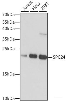 Immunofluorescence analysis of NIH-3T3 cells using PAK3 Polyclonal Antibody at dilution of  1:100. Blue: DAPI for nuclear staining.