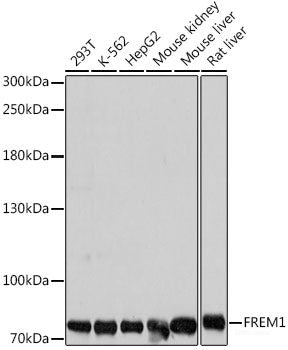 Immunohistochemistry of paraffin-embedded Rat spleen using AMPKα1 Polyclonal Antibody at dilution of  1:200 (40x lens).