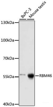 Immunofluorescence analysis of U-2 OS cells using Rb Polyclonal Antibody at dilution of  1:100. Blue: DAPI for nuclear staining.