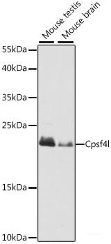 Immunohistochemistry of paraffin-embedded Mouse spinal cord using THBS1 Polyclonal Antibody at dilution of  1:200 (40x lens).