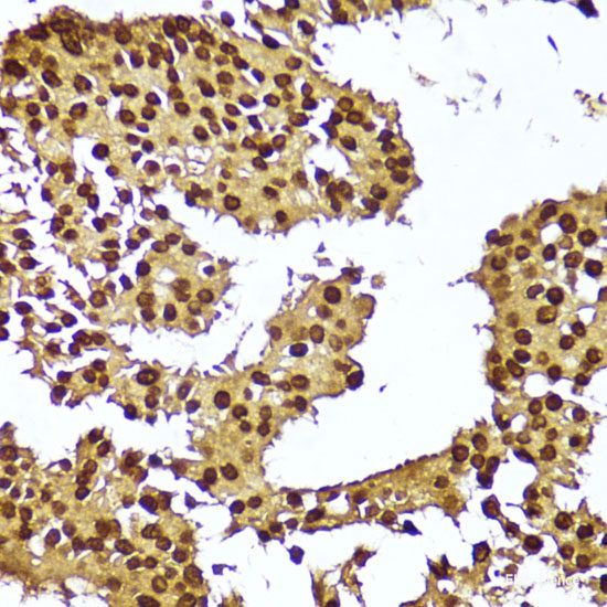 Immunohistochemistry of paraffin-embedded Rat brain using THY1 Polyclonal Antibody at dilution of  1:100 (40x lens).