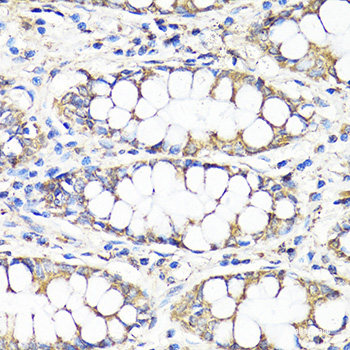Immunofluorescence analysis of C6 cells using UCP3 Polyclonal Antibody at dilution of  1:100. Blue: DAPI for nuclear staining.
