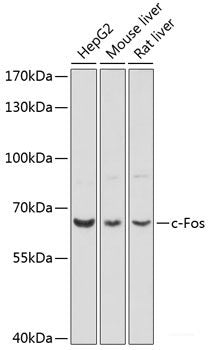 Immunohistochemistry of paraffin-embedded Rat lung using SCGB1A1 Polyclonal Antibody at dilution of  1:100 (40x lens).