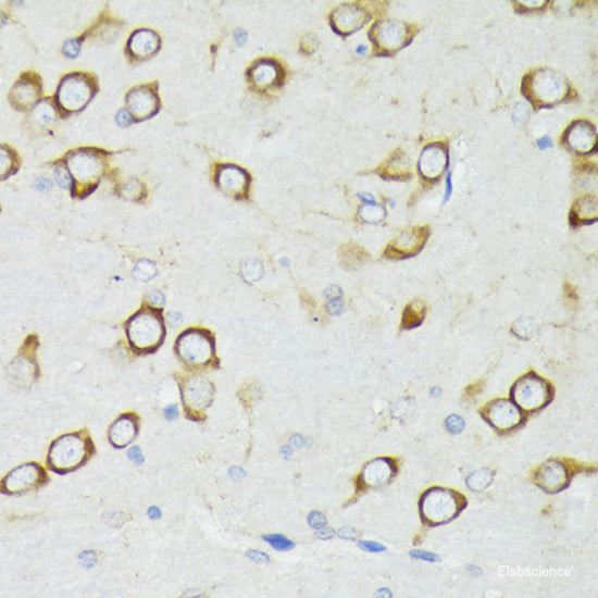 Immunohistochemistry of paraffin-embedded Rat lung using SCGB1A1 Polyclonal Antibody at dilution of  1:100 (40x lens).