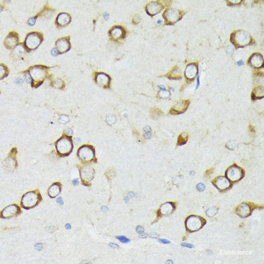 Immunohistochemistry of paraffin-embedded Rat lung using SCGB1A1 Polyclonal Antibody at dilution of  1:100 (40x lens).