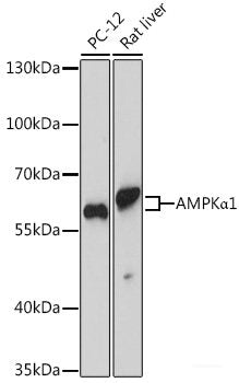 Immunohistochemistry of paraffin-embedded Human liver using GLA Polyclonal Antibody at dilution of  1:100 (40x lens).