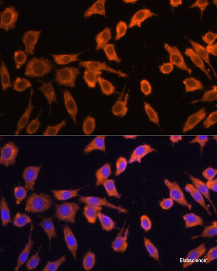Immunohistochemistry of paraffin-embedded Human colon carcinoma using VIL1 Polyclonal Antibody at dilution of  1:100 (40x lens).