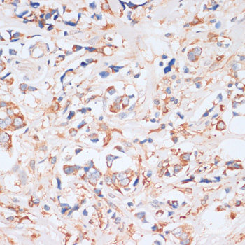 Immunohistochemistry of paraffin-embedded Rat heart using ARHGEF5 Polyclonal Antibody at dilution of  1:100 (40x lens).