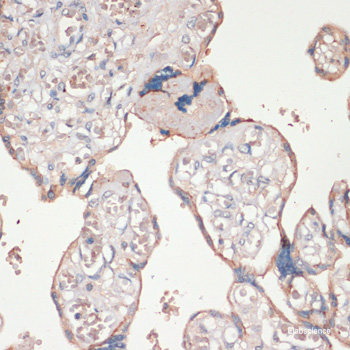 Immunohistochemistry of paraffin-embedded Human tonsil using TNFSF11 Polyclonal Antibody at dilution of  1:200 (40x lens).