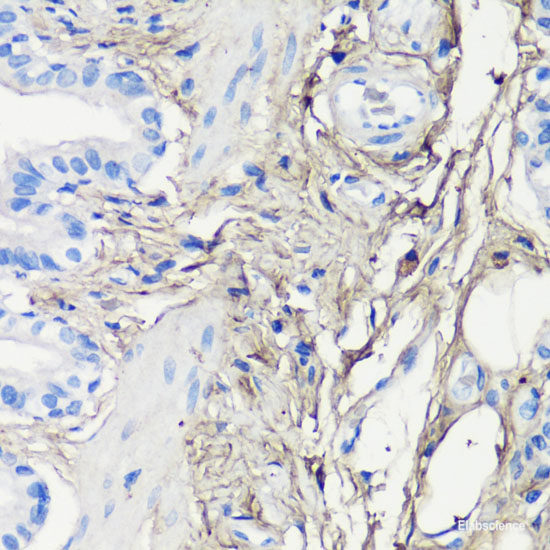 Immunofluorescence analysis of C6 cells using BECN1 Polyclonal Antibody at dilution of  1:100. Blue: DAPI for nuclear staining.