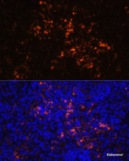 Immunofluorescence analysis of C6 cells using RAB11A Polyclonal Antibody at dilution of  1:100. Blue: DAPI for nuclear staining.
