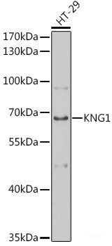 Immunofluorescence analysis of U-2 OS cells using SOCS2 Polyclonal Antibody at dilution of  1:100 (40x lens). Blue: DAPI for nuclear staining.