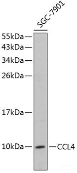 Immunohistochemistry of paraffin-embedded Human lung cancer using TAX1BP1 Polyclonal Antibody at dilution of  1:100 (40x lens).