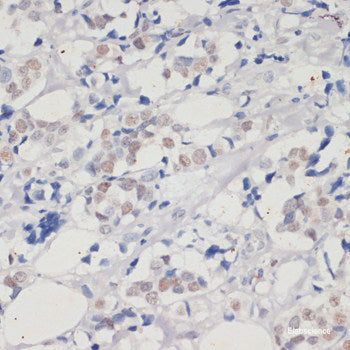 Immunofluorescence analysis of C6 cells using KEAP1 Polyclonal Antibody at dilution of  1:100. Blue: DAPI for nuclear staining.