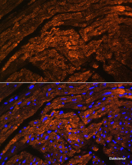 Immunohistochemistry of paraffin-embedded Human mammary cancer using NR1I3 Polyclonal Antibody at dilution of  1:200 (40x lens).