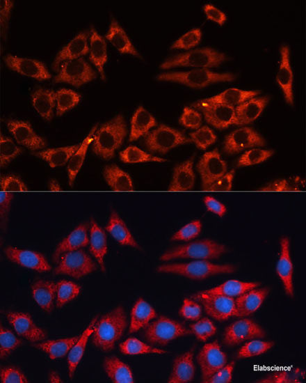 Immunohistochemistry of paraffin-embedded Rat liver using ARL4A Polyclonal Antibody at dilution of  1:100 (40x lens).