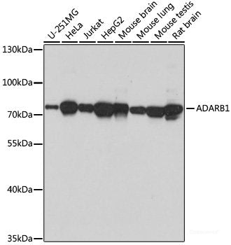 Immunofluorescence analysis of U2OS cells using DDX17 Polyclonal Antibody at dilution of  1:100. Blue: DAPI for nuclear staining.