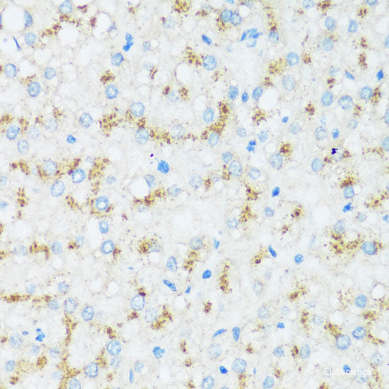 Immunohistochemistry of paraffin-embedded Human stomach using CAPN9 Polyclonal Antibody at dilution of  1:100 (40x lens).