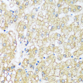 Immunofluorescence analysis of C6 cells using P2RY12 Polyclonal Antibody at dilution of  1:100. Blue: DAPI for nuclear staining.