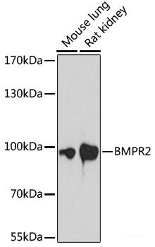 Immunohistochemistry of paraffin-embedded Rat liver using TARDBP Polyclonal Antibody at dilution of  1:200 (40x lens).