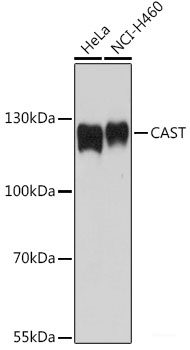 Immunofluorescence analysis of L929 cells using GAPVD1 Polyclonal Antibody at dilution of  1:100. Blue: DAPI for nuclear staining.