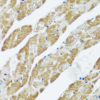 Immunohistochemistry of paraffin-embedded Mouse lung using ERCC3 Polyclonal Antibody at dilution of  1:200 (40x lens).