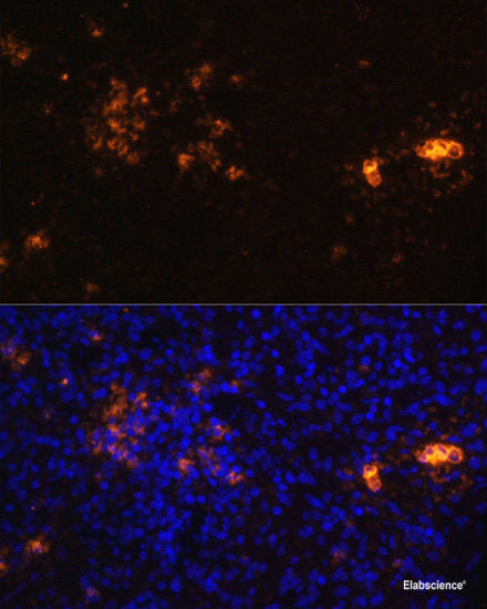 Immunohistochemistry of paraffin-embedded Human lung using ARL6IP4 Polyclonal Antibody at dilution of  1:100 (40x lens).
