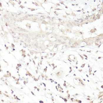 Immunohistochemistry of paraffin-embedded Human liver using ASB4 Polyclonal Antibody at dilution of  1:100 (40x lens).