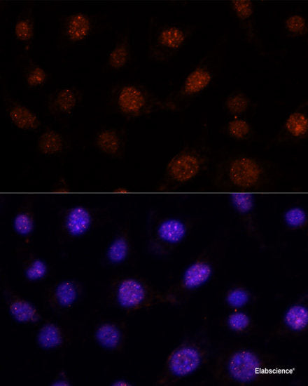 Immunohistochemistry of paraffin-embedded Rat testis using C12orf10 Polyclonal Antibody at dilution of  1:100 (40x lens).