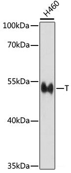 Immunohistochemistry of paraffin-embedded Rat liver using BRSK1 Polyclonal Antibody at dilution of  1:100 (40x lens).