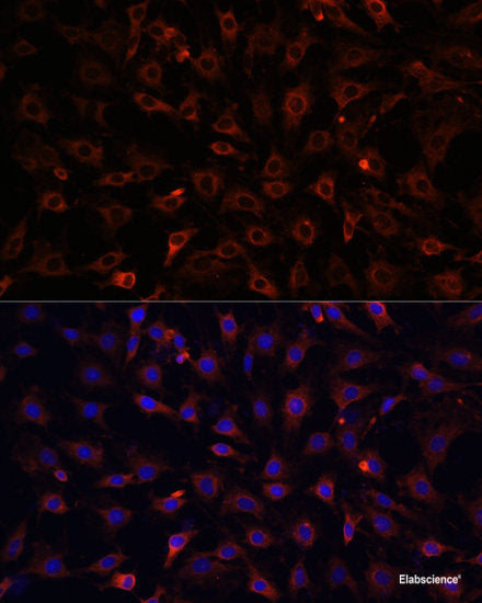 Immunohistochemistry of paraffin-embedded Rat spleen using YKL-40 / CHI3L1 Polyclonal Antibody at dilution of  1:100 (40x lens).