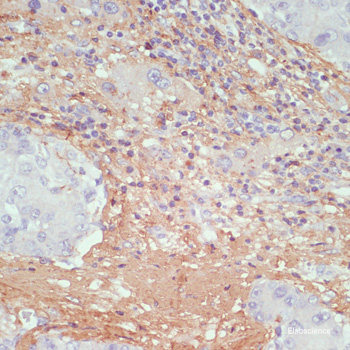Immunofluorescence analysis of L929 cells using ZCCHC3 Polyclonal Antibody at dilution of  1:100. Blue: DAPI for nuclear staining.