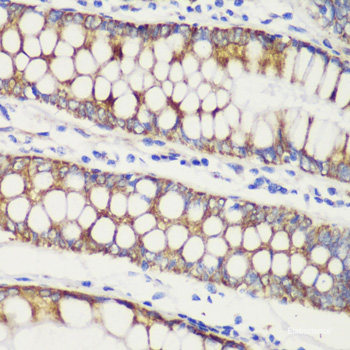 Immunohistochemistry of paraffin-embedded Rat brain using AVP Polyclonal Antibody at dilution of  1:100 (40x lens).