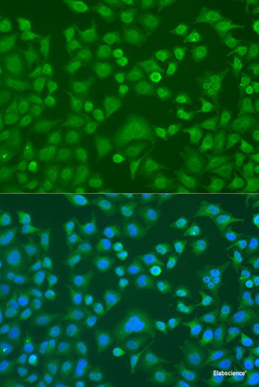 Immunohistochemistry of paraffin-embedded Rat liver using LRRK2 Polyclonal Antibody at dilution of  1:200 (40x lens).