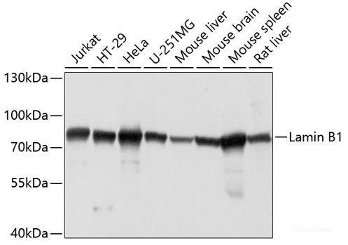 Immunofluorescence analysis of Mouse testis using Kctd19 Polyclonal Antibody at dilution of  1:100. Blue: DAPI for nuclear staining.
