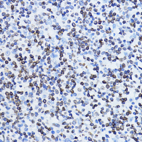 Immunohistochemistry of paraffin-embedded Human colon using BLOC1S3 Polyclonal Antibody at dilution of  1:100 (40x lens).
