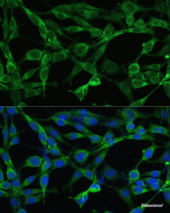 Immunohistochemistry of paraffin-embedded Rat testis using C10orf62 Polyclonal Antibody at dilution of  1:100 (40x lens).