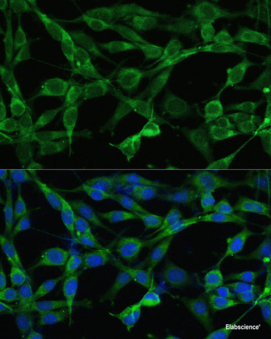 Immunohistochemistry of paraffin-embedded Rat testis using C10orf62 Polyclonal Antibody at dilution of  1:100 (40x lens).