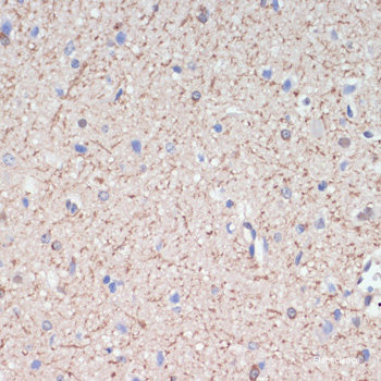 Immunofluorescence analysis of HeLa cells using PRKAA1/PRKAA2 Polyclonal Antibody at dilution of  1:100. Blue: DAPI for nuclear staining.