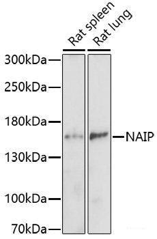 Immunohistochemistry of paraffin-embedded Rat testis using MAPK1/MAPK3 Polyclonal Antibody at dilution of  1:200 (40x lens).