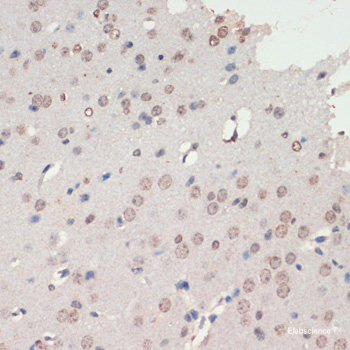Immunohistochemistry of paraffin-embedded Rat bronchus using DEPDC6 Polyclonal Antibody at dilution of  1:200 (40x lens).
