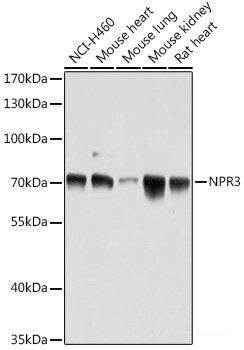 Immunohistochemistry of paraffin-embedded Human colon carcinoma using MLKL Polyclonal Antibody at dilution of  1:200 (40x lens).