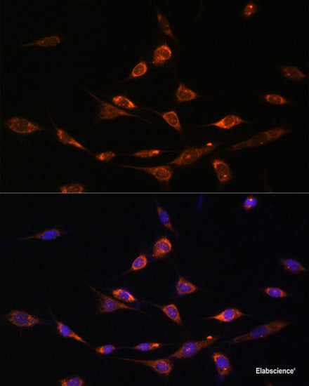 Immunofluorescence analysis of NIH-3T3 cells using PIK3R3 Polyclonal Antibody at dilution of  1:100. Blue: DAPI for nuclear staining.