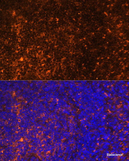 Immunohistochemistry of paraffin-embedded Rat brain using Map2 Polyclonal Antibody at dilution of  1:100 (40x lens).